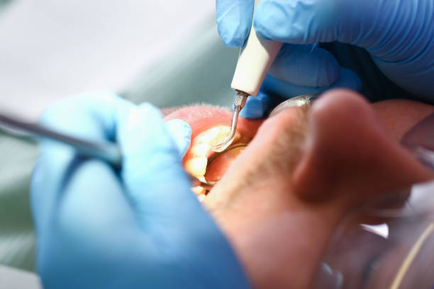 Best Weekend Emergency Dental Services in Chevy Chase View, MD