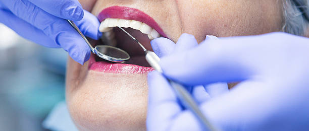 Best Emergency Denture Repair in Chevy Chase View, MD